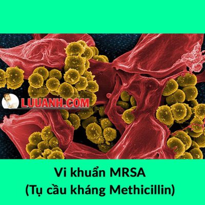 Ciprofloxacin - Kháng sinh nhóm Fluoroquinolon thế hệ hai 6 Kháng sinh có tác dụng trên một số chủng tụ cầu kháng Methicillin