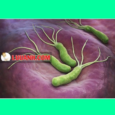 Metronidazol - Kháng sinh điều trị Amip, Giardia, Lậu 6 Metronidazol dùng trong phác đồ điều trị vi khuẩn HP