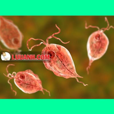 Metronidazol - Kháng sinh điều trị Amip, Giardia, Lậu 7 Điều trị Trichomonas vaginalis