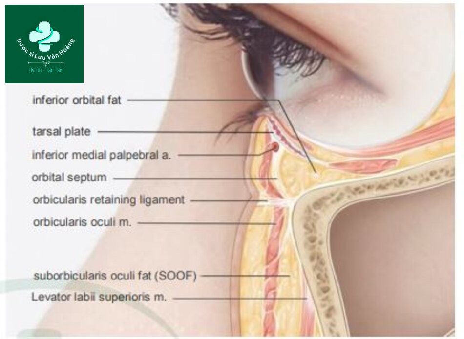 Kỹ thuật làm đầy hõm mắt dưới, rãnh nước mắt, và rãnh mí má 12 Fig. 4.34 A sagittal section of the infraorbital region