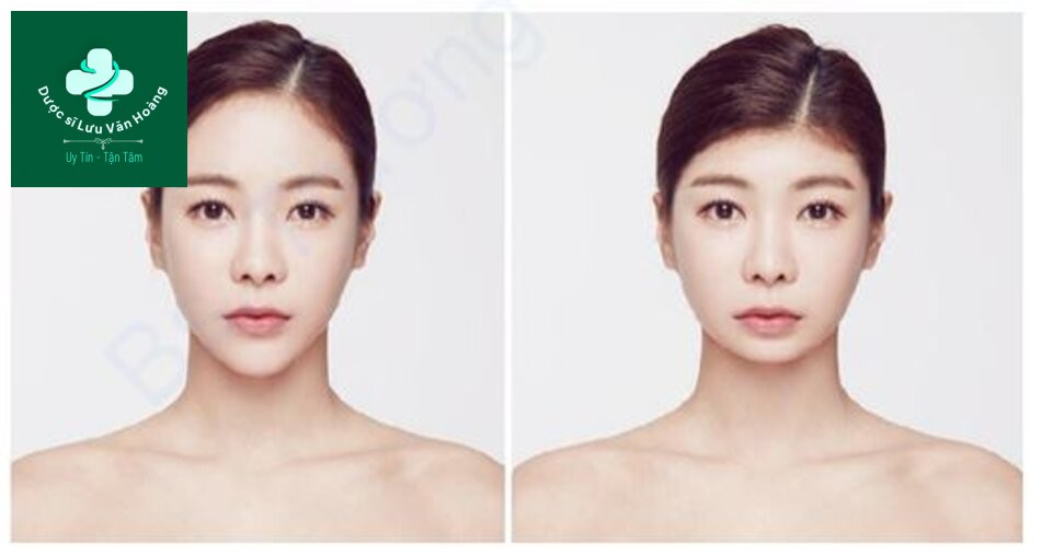 Hình 1.10 Tỷ lệ cân đối cũng rất quan trọng đối với đường nét trên khuôn mặt. Thay đổi tỷ lệ của đường viền khuôn mặt bằng cách thu hẹp chiều rộng của trán hoặc cằm, hoặc mở rộng khoảng cách sinh học, có thể làm biến dạng khuôn mặt và khiến khuôn mặt mất đi tương xứng, ngay cả khi kích thước và vị trí của các đặc điểm riêng lẻ vẫn còn nguyên vẹn