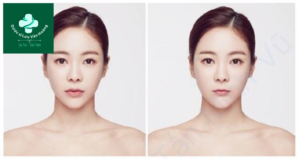 Hình 1.8 Một khuôn mặt có miệng nhỏ không cân xứng, như trong hình tổng hợp, có xu hướng trông kỳ quặc và mất cân đối